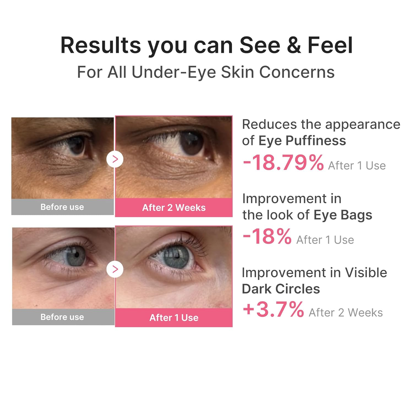 Zottoz PDRN Pink Caffeine Collagen Eye Patch – 10-Minute Eye Revival Treatment